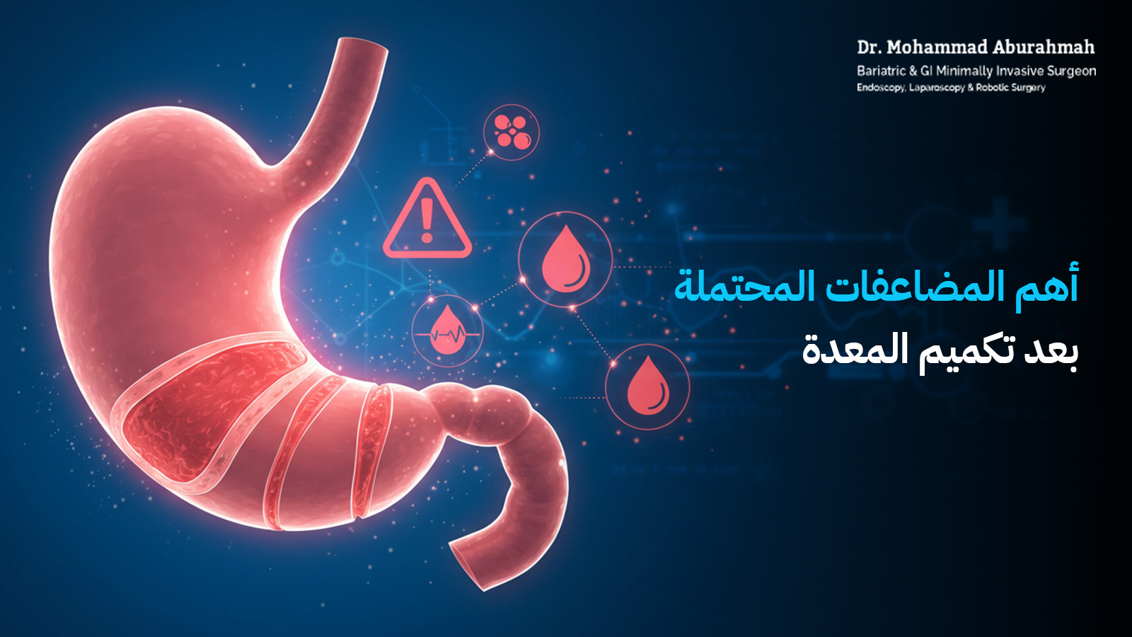 تكميم المعدة